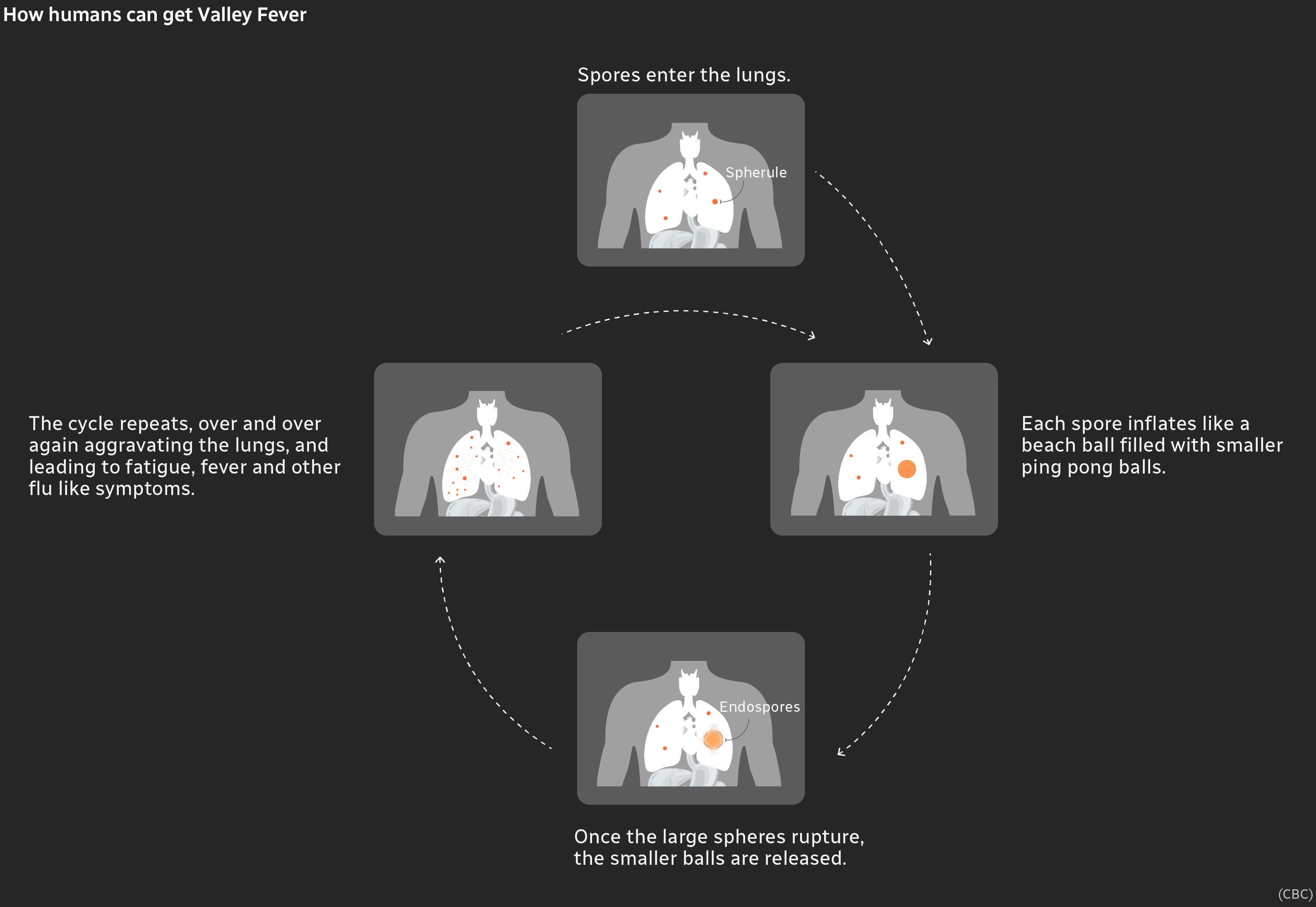 Infographic showing the cycle of how humnas can get the Valley fever.