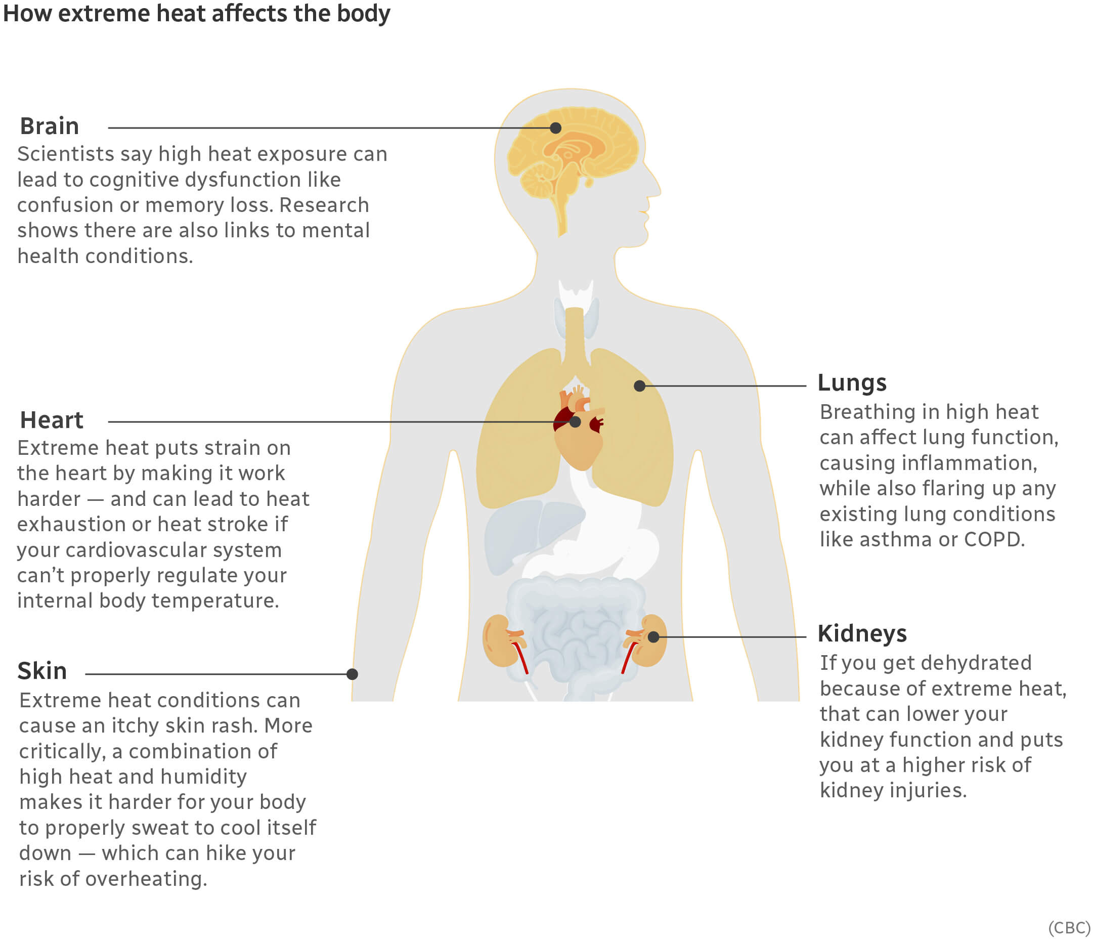 Human body diagram showing the internal effects of the extreme heat exposure.